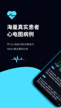 心电图ECG官方app下载 v1.0